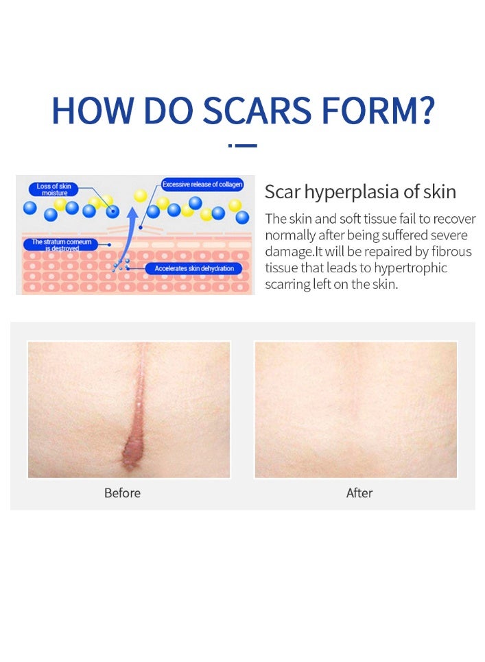 ام اس ال اي ام كريم إزالة الندوب MSLAM 20 جرام - عناية دقيقة، تلاشي الندوب الجديدة والقديمة، استعادة البشرة الناعمة - Image 5